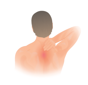 upper back pain